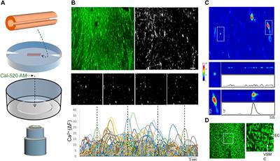 Restricted Intimal Ca2+ Signaling Associated With Cardiovascular Disease